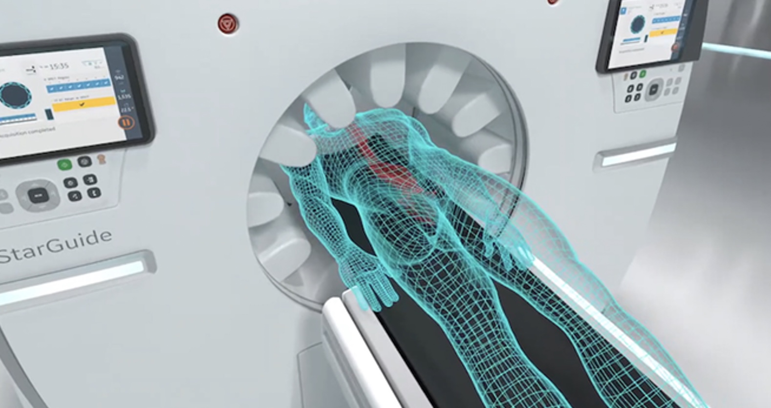 Hệ thống SPECT/CT. Nguồn ảnh: GE HealthCare.