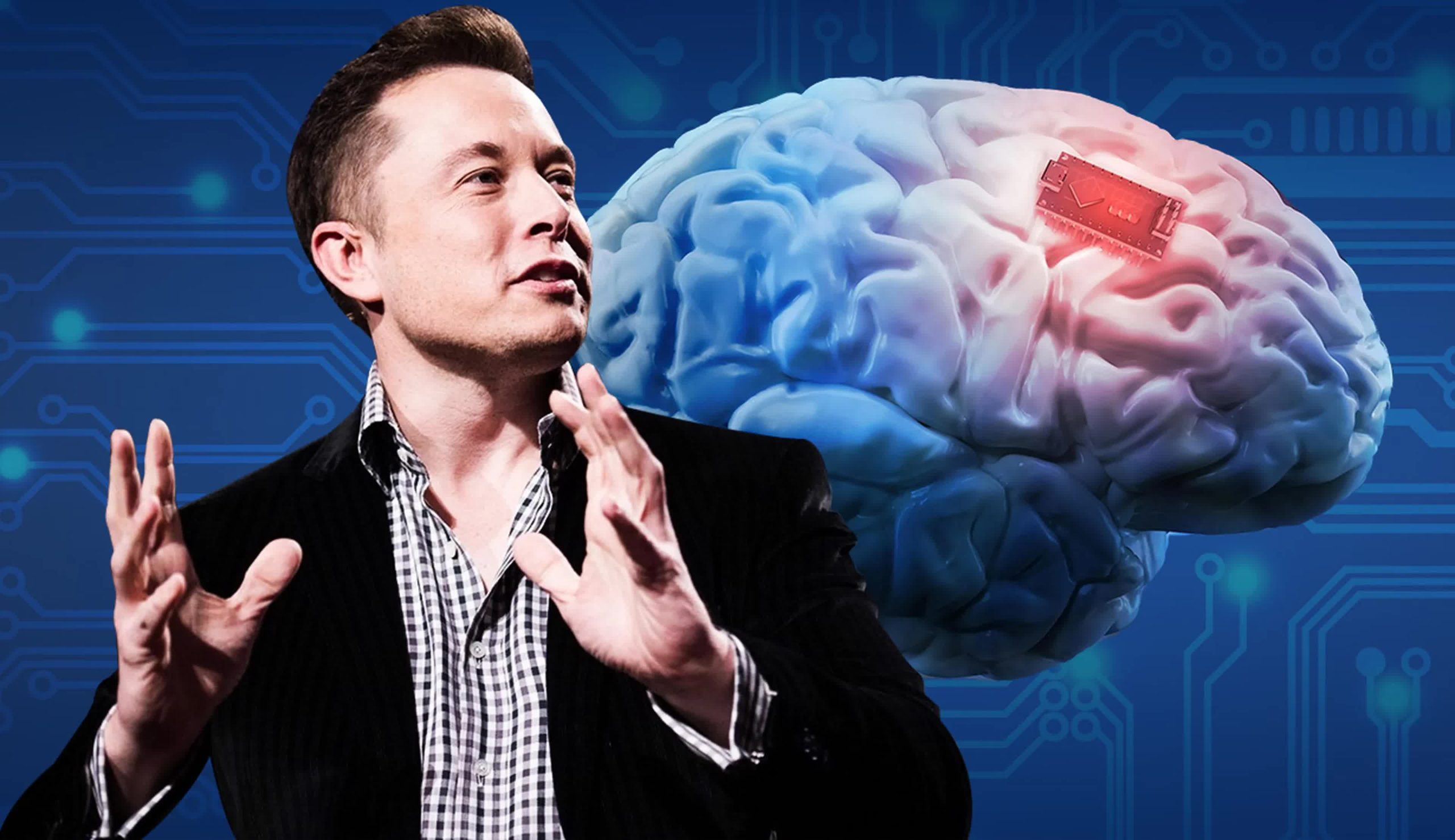 FDA cho phép Neuralink của Elon Musk cấy ghép não ở người The FDA gives Elon Musk