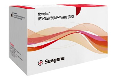 1724753691 323 Seegene da lap tuc phat trien cac bo xet nghiem TechTimes.vn Seegene đã lập tức phát triển các bộ xét nghiệm phân tử PCR cho bệnh đậu mùa khỉ ngay sau tuyên bố khẩn cấp của WHO